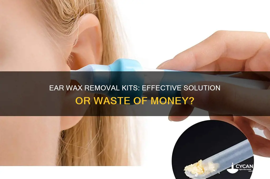 do ear wax removal kits work