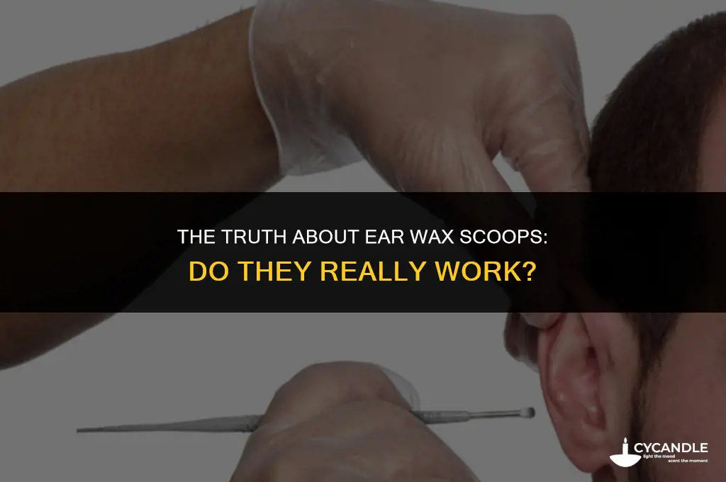 do ear wax scoops work