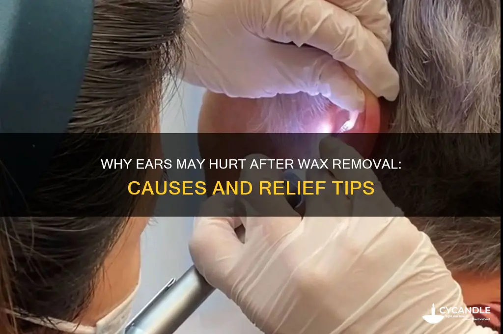 do ears hurt after wax removal