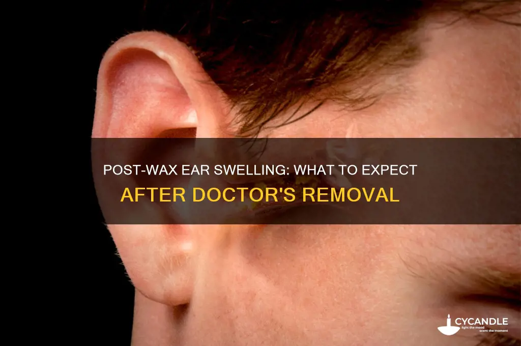 do ears swell after wax removal by doctor