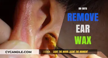 Do ENTs Remove Ear Wax? Understanding Ear Care and Wax Management