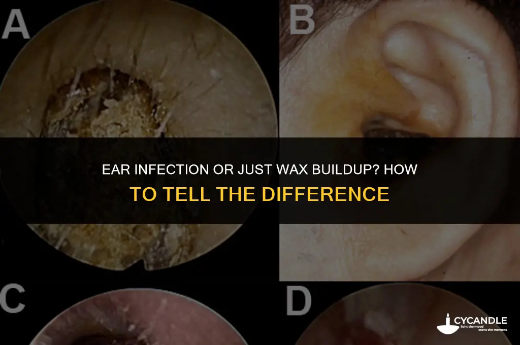 do i have an ear infection or wax