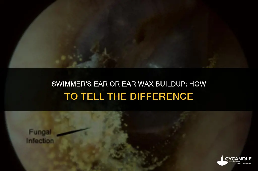 do i have swimmers ear or just ear wax