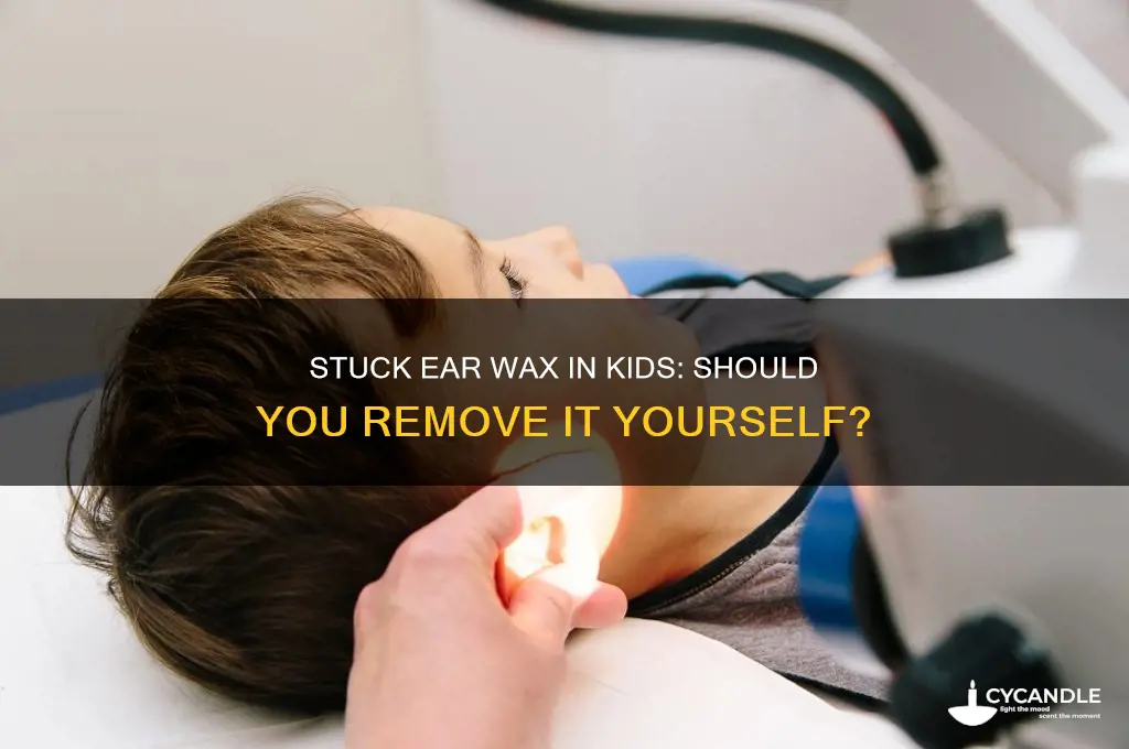 do i need to remove my kid