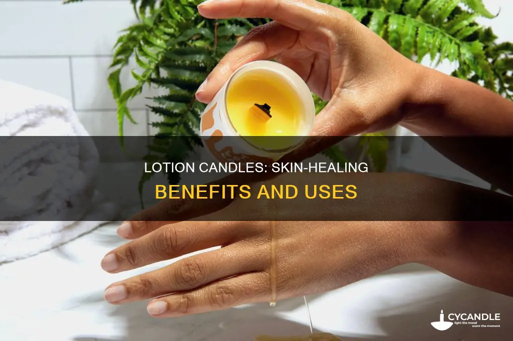 do lotion candles heal skin