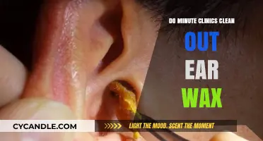 Do Minute Clinics Offer Ear Wax Removal Services?