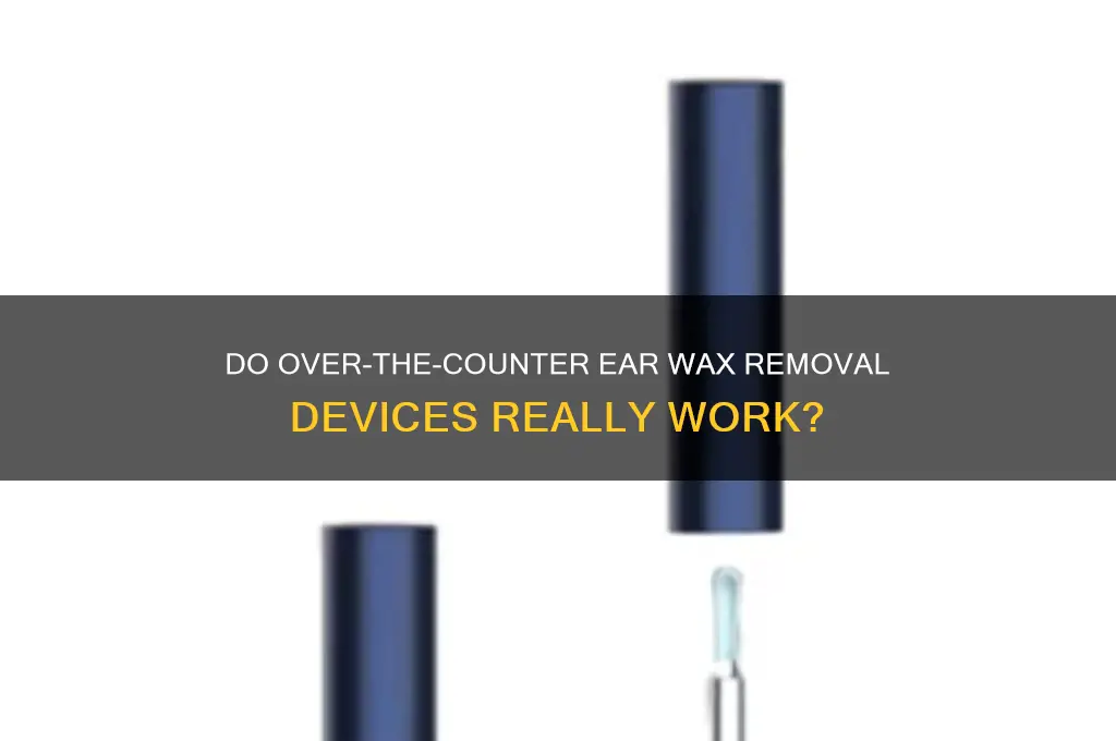 do over the counter ear wax removal devices work