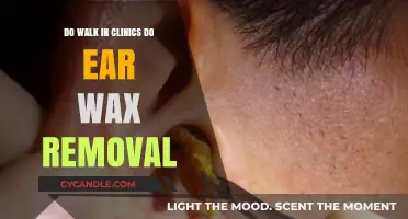 Do Walk-In Clinics Offer Ear Wax Removal Services? Find Out