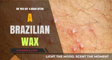 Post-Brazilian Wax Rash: Causes, Prevention, and Soothing Tips