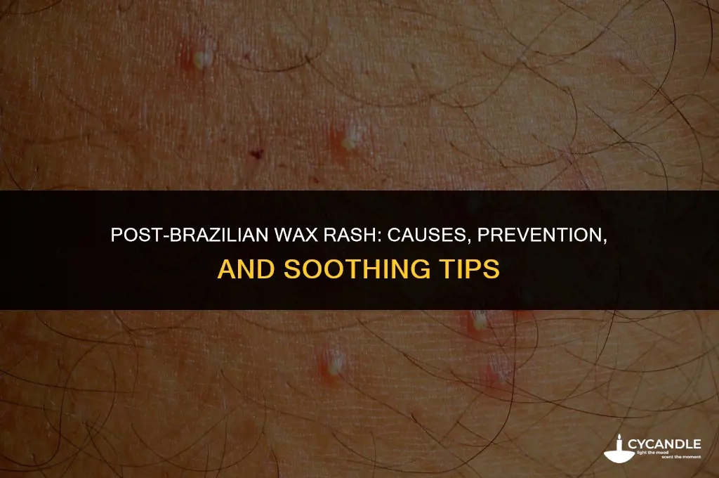 do you get a rash after a brazilian wax