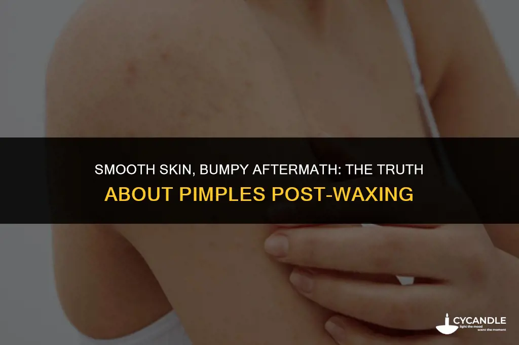 do you get pimples after waxing