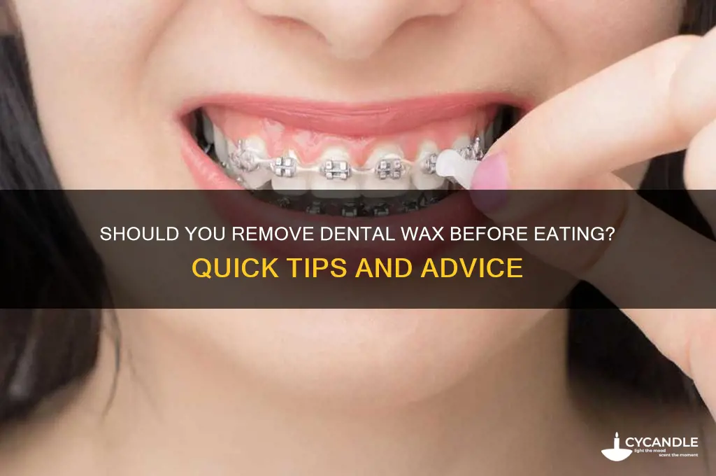 do you remove dental wax before eating