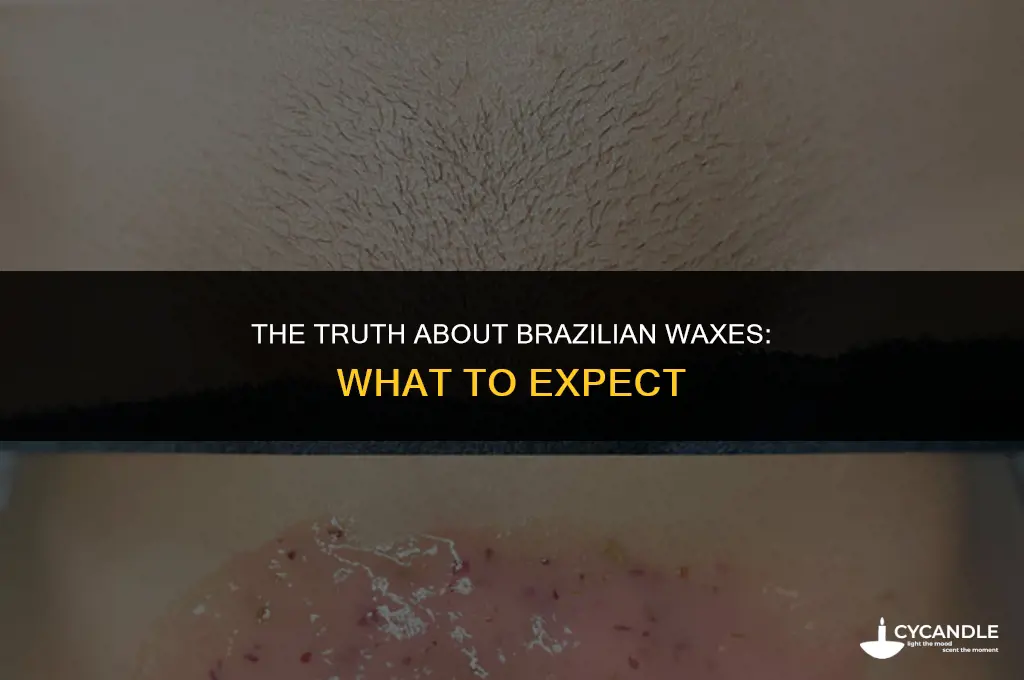 does a brazilian wax get everything