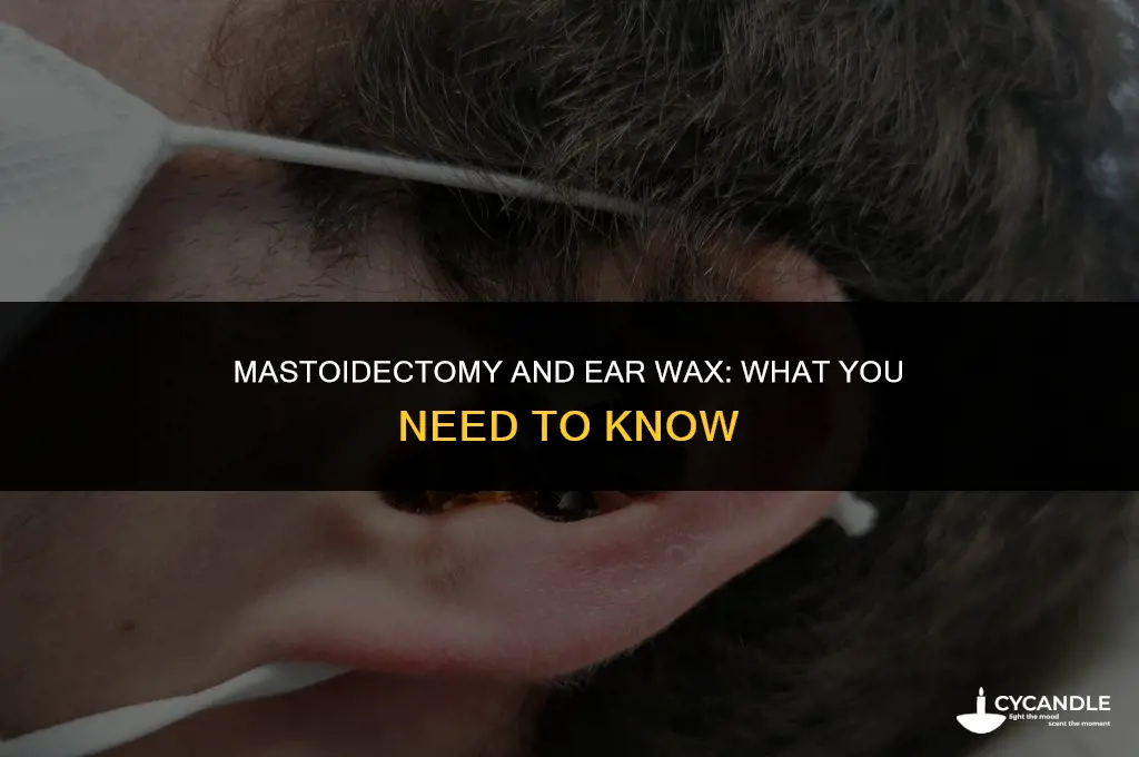 does a mastoidectomy cause increased ear wax