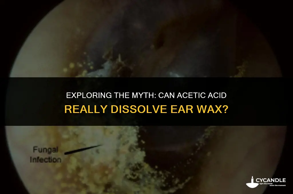 does acetic acid dissolve ear wax