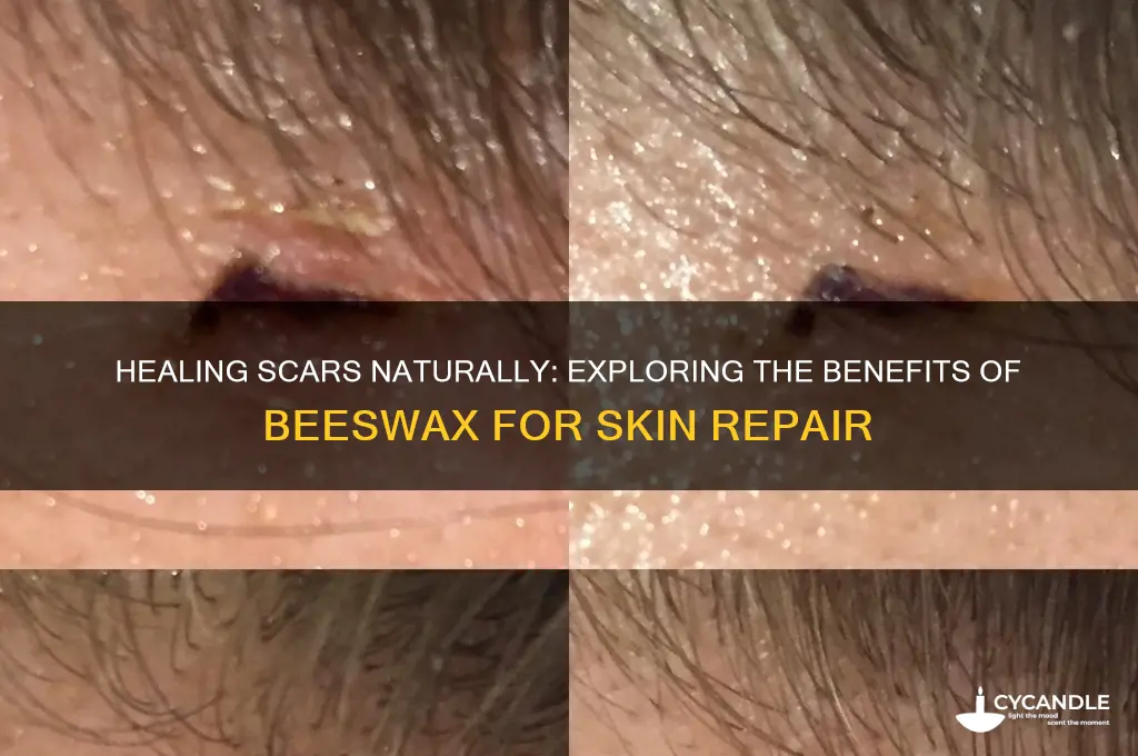 does beeswax help scars