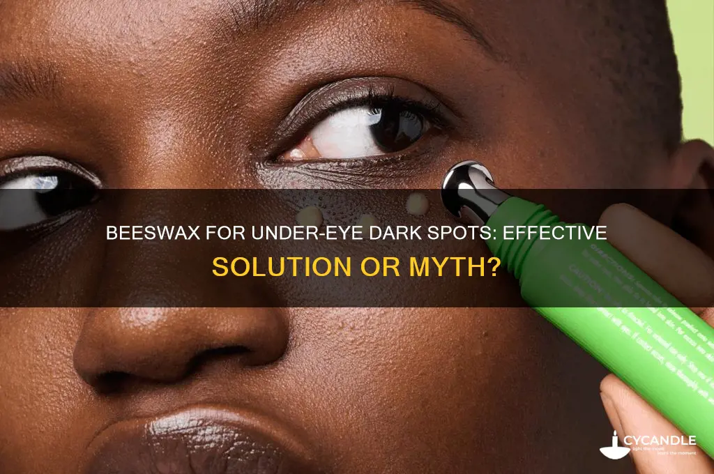 does beeswax remove dark spots under eyes
