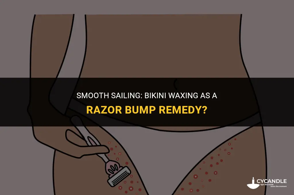 does bikini waxing get rid of razor bumps