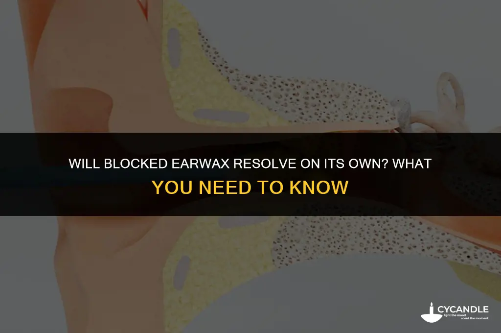 does blocked ear wax resolve naturally