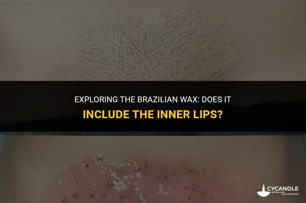 does brazilian wax get inner lips