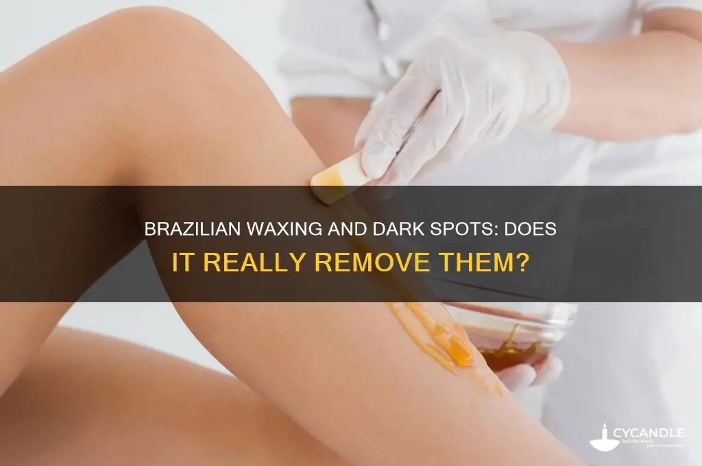 does brazilian waxing remove dark spots
