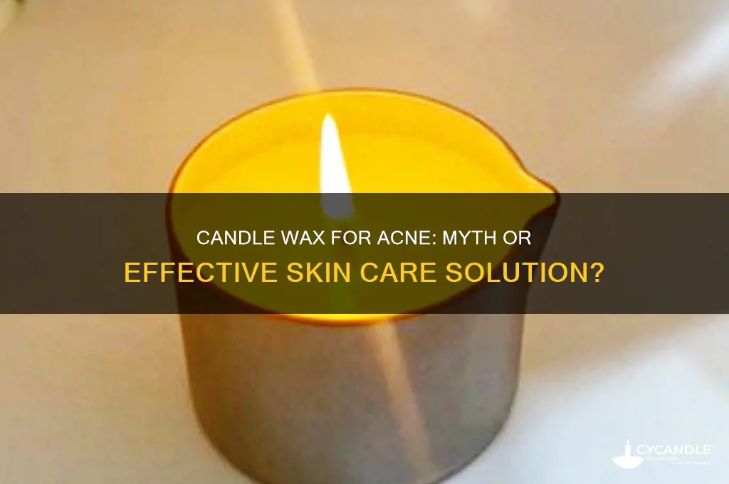 does candle wax help with acne
