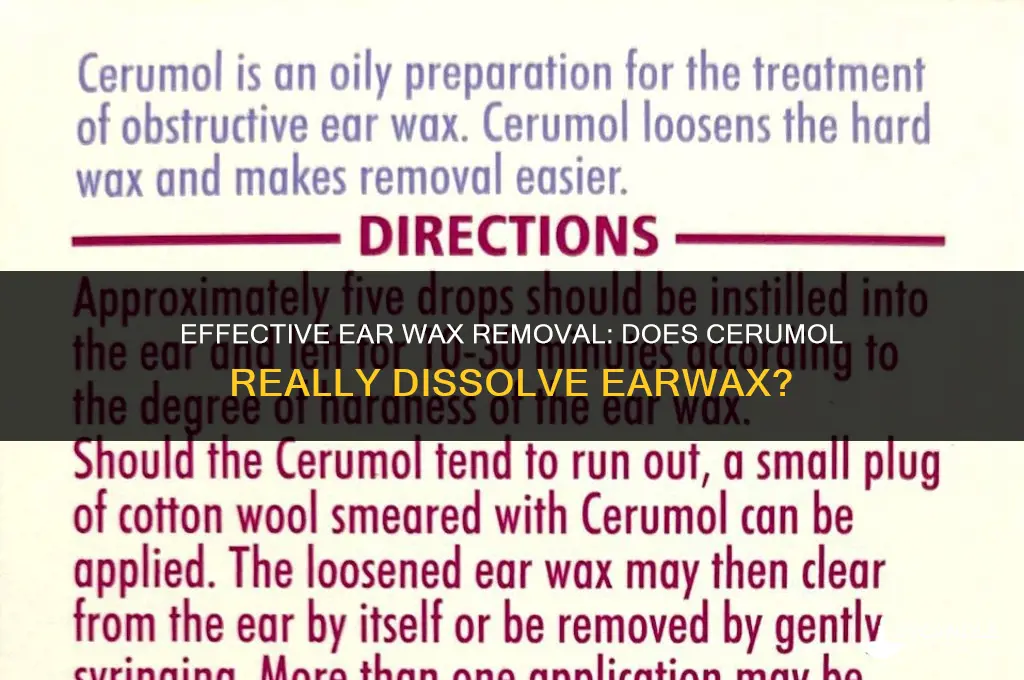 does cerumol dissolve ear wax