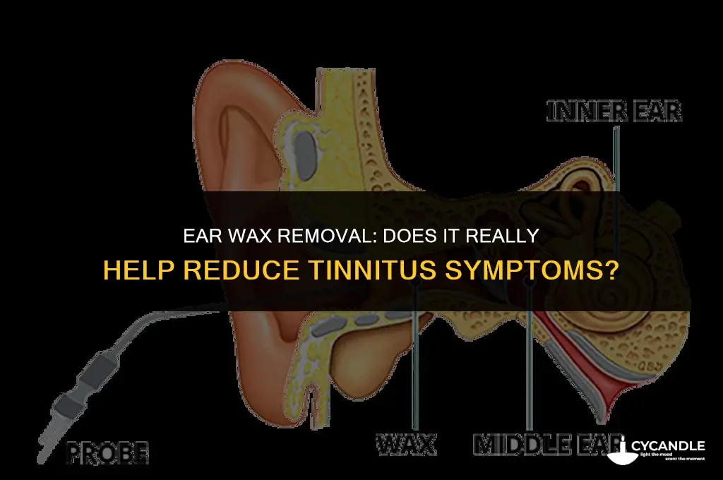 does cleaning ear wax reduce tinnitus