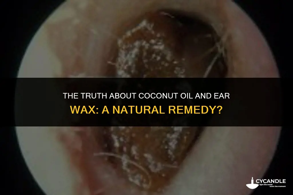 does coconut oil help with ear wax