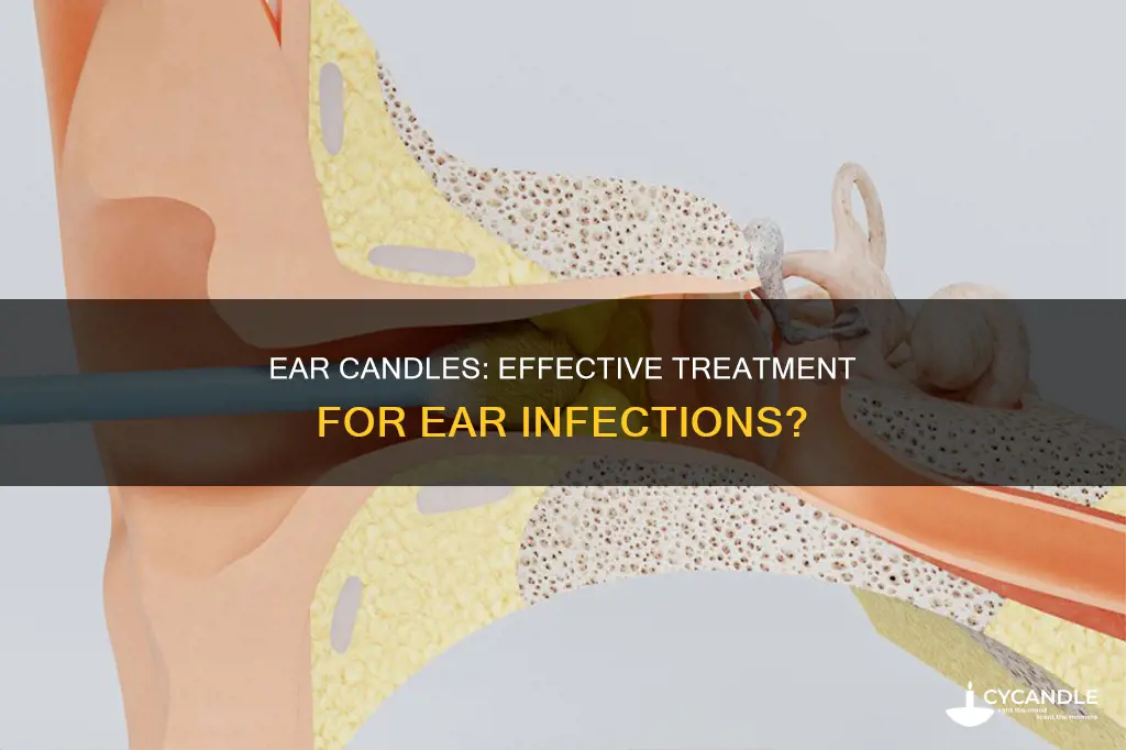 does ear candles help if you ear infection
