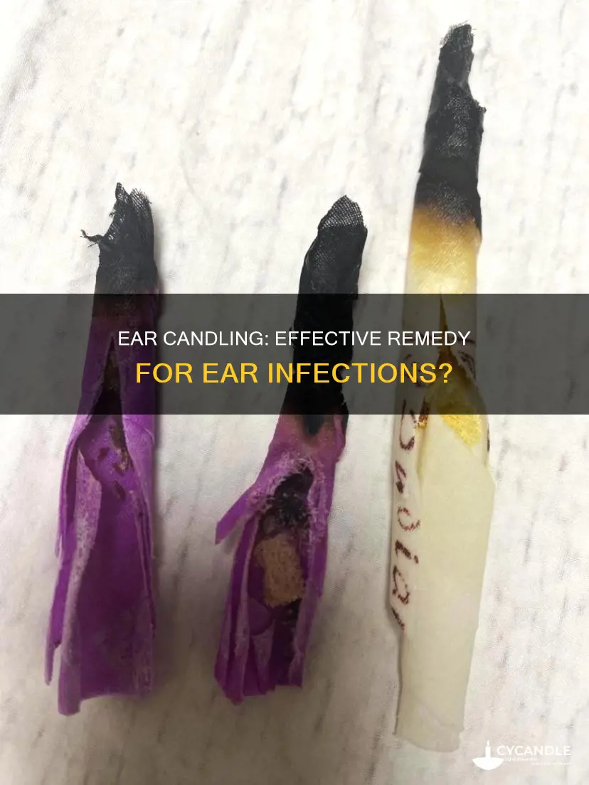 does ear candling cure ear infections
