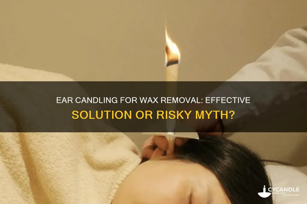 does ear candling get rid of wax