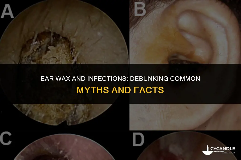 does ear wax cause ear infection