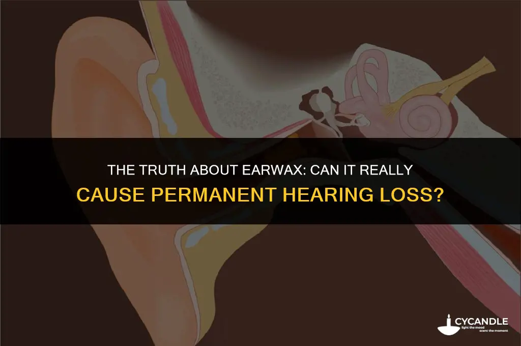 does ear wax cause permanent hearing loss