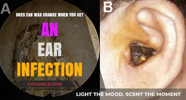 Ear Wax Transformation: A Sign of Infection?