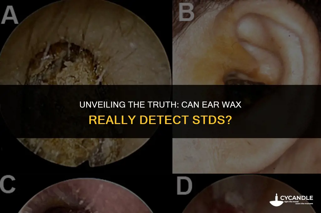 does ear wax detect std