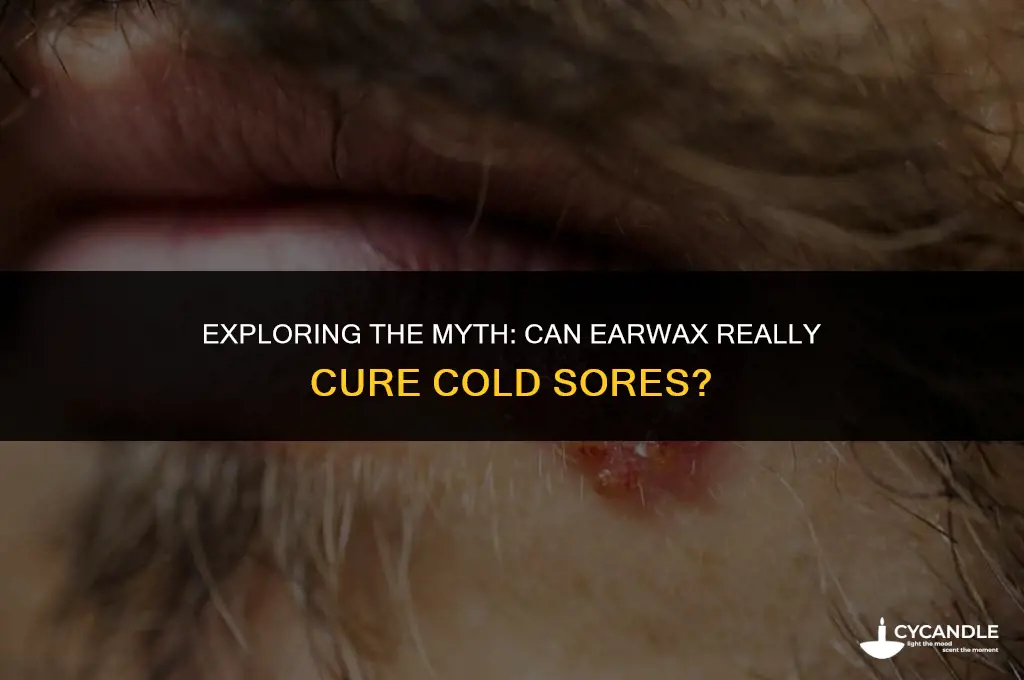 does ear wax get rid of cold sores
