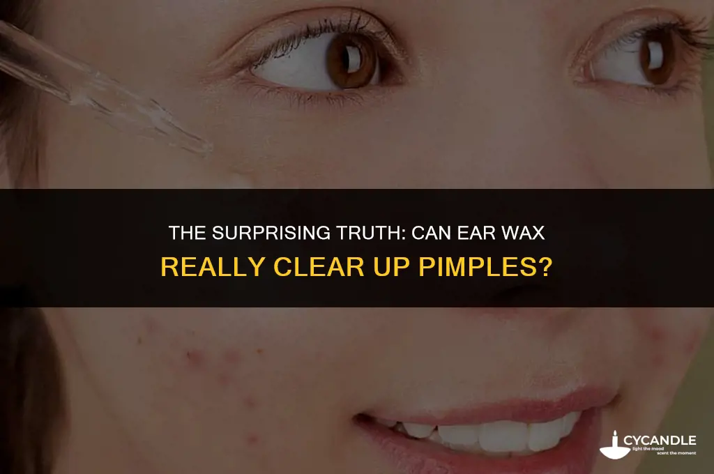 does ear wax get rid of pimples