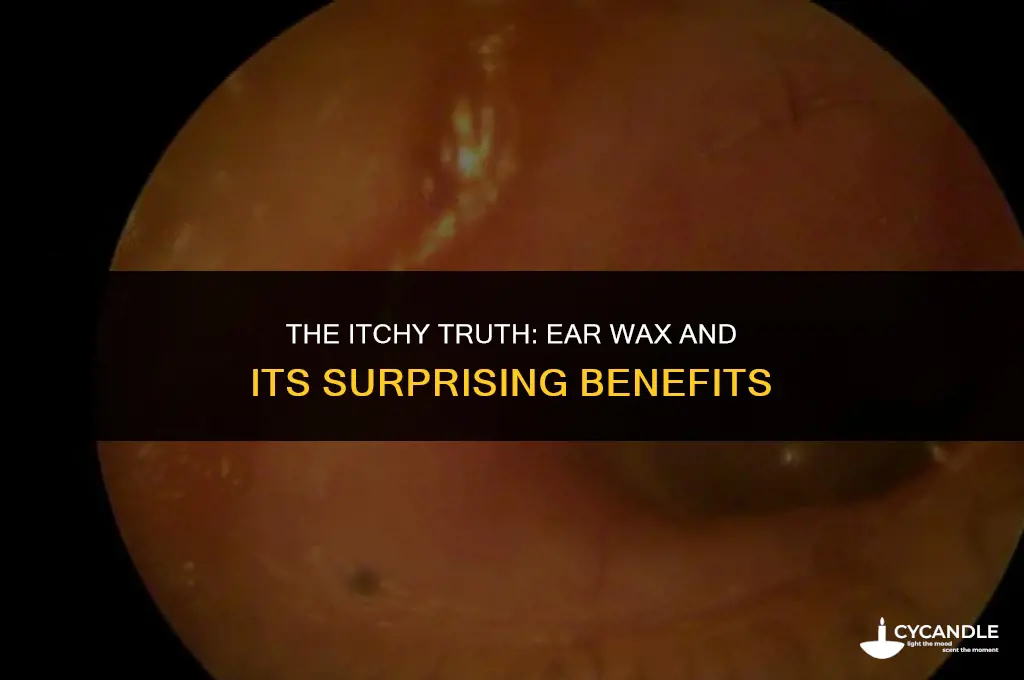 does ear wax make your ears itch