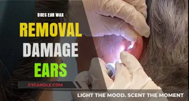 Ear Wax Removal: Safe Practice or Potential Ear Damage Risk?