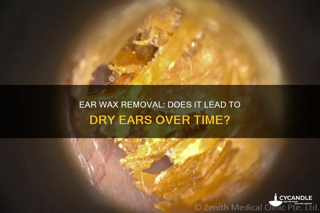 does ear wax removal eventually dry out