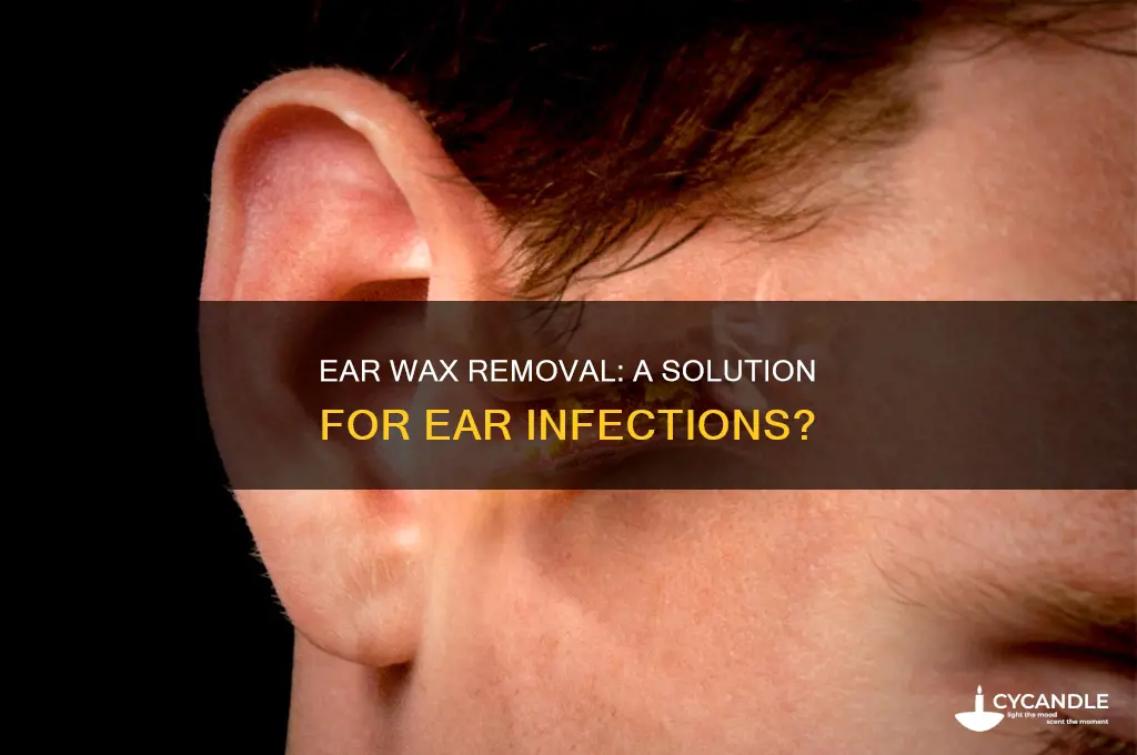 does ear wax removal help with ear infections