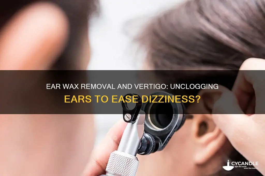 does ear wax removal help with vertigo