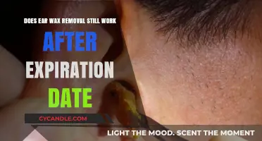 Expired Ear Wax Removal: Does It Still Work Safely?