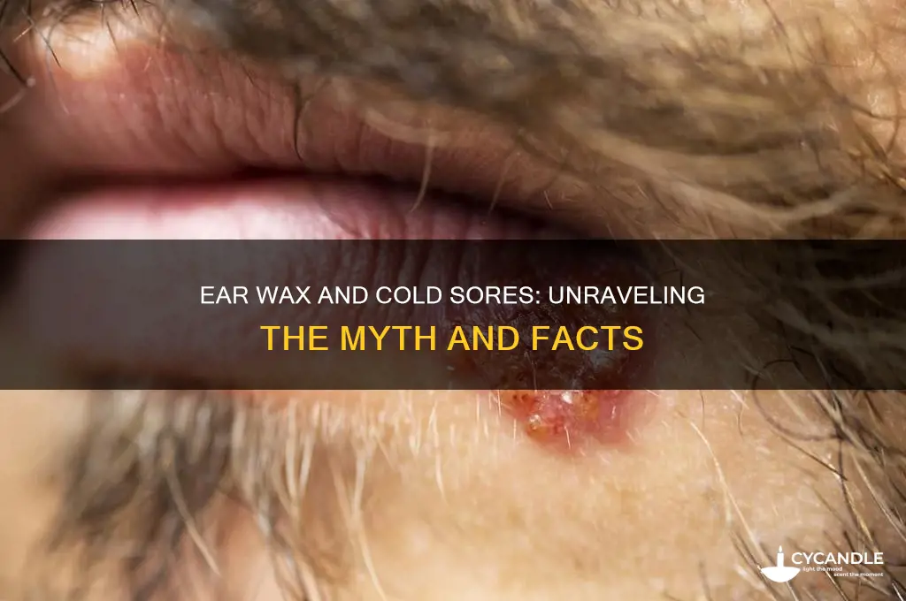does ear wax remove cold sores