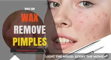 Ear Wax for Pimples: Myth or Unconventional Acne Solution?