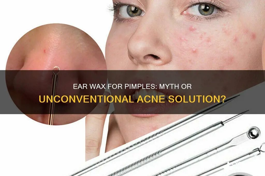 does ear wax remove pimples