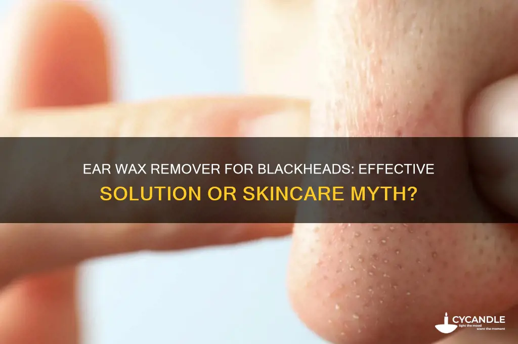 does ear wax remover work on blackheads
