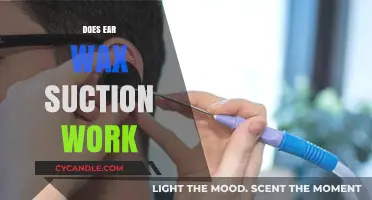 Exploring Ear Wax Suction: Does This Method Really Work?
