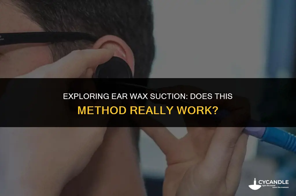 does ear wax suction work